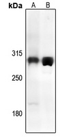 TRAP240 Rabbit Polyclonal Antibody