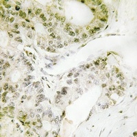 Anti-TRAP240 Antibody