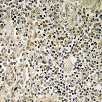 ZNF225 Rabbit Polyclonal Antibody