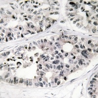 Collagen 7 alpha 1 Antibody