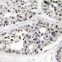 Collagen 7 alpha 1 antibody