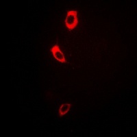 Collagen 7 alpha 1 Antibody