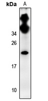 CDC50C Rabbit Polyclonal Antibody
