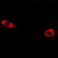 Anti-CELSR3 Antibody