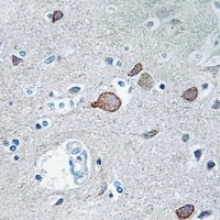 Anti-CEND1 Antibody