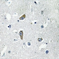 Anti-CDK5RAP2 Antibody