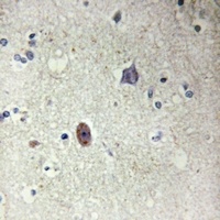 Collagen 4 alpha 3 antibody