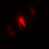 Anti-Collagen 4 alpha 3 Antibody
