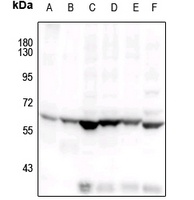 COX1 Rabbit Polyclonal Antibody