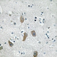 IFIT1 Antibody