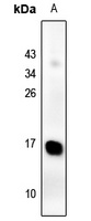 Galectin 2 Rabbit Polyclonal Antibody