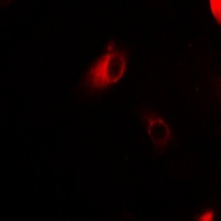 Galectin 2 Rabbit Polyclonal Antibody