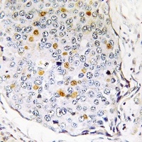 Anti-RPS27L Antibody