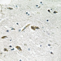 Anti-RPL39L Antibody