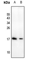 ATP5D Antibody