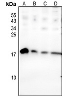 BAGE2 Rabbit Polyclonal Antibody