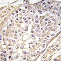 BAGE2 Rabbit Polyclonal Antibody