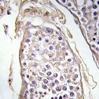BAGE3 Antibody