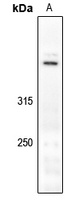 Dynein HC Rabbit Polyclonal Antibody