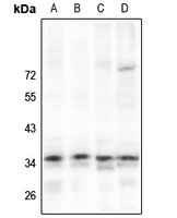 NKX2-4 Rabbit Polyclonal Antibody