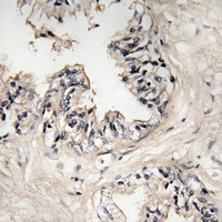 Anti-MRPS36 Antibody