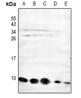 NDUFC1 Antibody