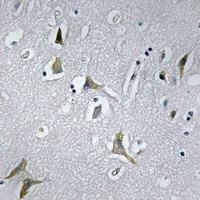 NDUFC1 antibody