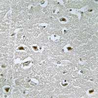 URB1 Antibody