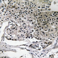 Anti-PIGY Antibody