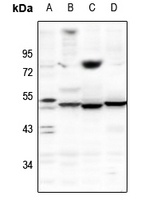 Kv10.1 Rabbit Polyclonal Antibody