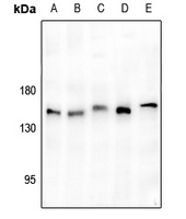 ULK1 Rabbit Polyclonal Antibody