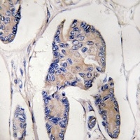 Anti-ULK1 Antibody