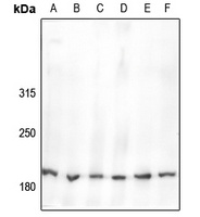 Nav1.2 Rabbit Polyclonal Antibody