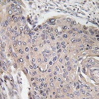 Anti-SPTBN5 Antibody
