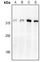 Cav3.2 Rabbit Polyclonal Antibody