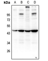 ZNF691 Rabbit Polyclonal Antibody