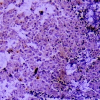 Collagen 2 alpha 1 Antibody