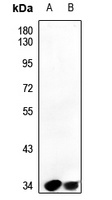 PAR4 Rabbit Polyclonal Antibody