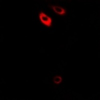 Frizzled 1 Rabbit Polyclonal Antibody