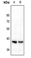 Kappa Opioid Receptor Rabbit Polyclonal Antibody