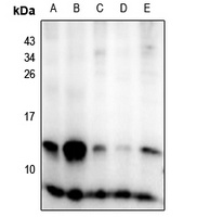 Insulin Rabbit Polyclonal Antibody