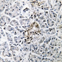 Insulin Rabbit Polyclonal Antibody