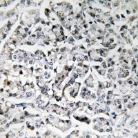 IL-11 antibody