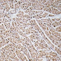 Anti-CXCL3 Antibody