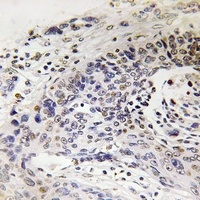 NEFH antibody