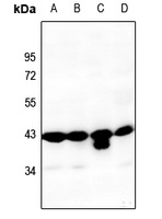 PAI1 Rabbit Polyclonal Antibody
