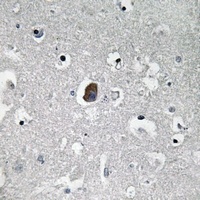 Anti-CD243 Antibody