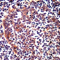 Anti-RAMP3 Antibody