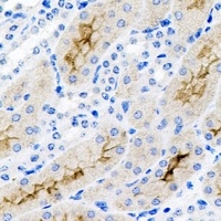 CD11b antibody