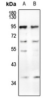 CD66a/b/c Antibody